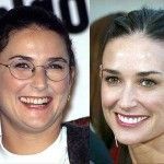 famosos cirugia estetica retoques operaciones botox demi moore